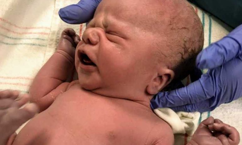 We moeten praten. Het hoofd van je baby is GROOT. Zijn vingers lijken op een zeester.” WAT? Hij gaf een papieren zakdoekje aan. Ik barstte in tranen los. – Moeder bevalt van zoon met dwerggroei: „Hij is speciaal ontworpen met een reden”