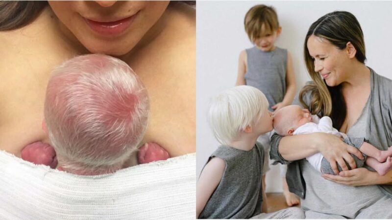 'Woe! Hij heeft echt heel blond haar.' IK WIST HET GEWOON. Mijn man glimlachte. 'Hij is een albinos.' Moeder van 2 zonen met albinisme zegt dat het beste wat ze in hen kan prenten 'zelfvertrouwen' is.