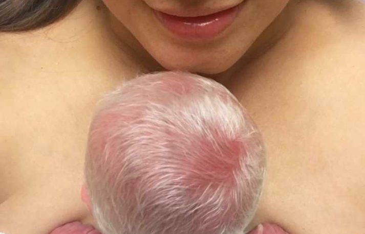 'Woe! Hij heeft echt heel blond haar.' IK WIST HET GEWOON. Mijn man glimlachte. 'Hij is een albinos.' Moeder van 2 zonen met albinisme zegt dat het beste wat ze in hen kan prenten 'zelfvertrouwen' is.
