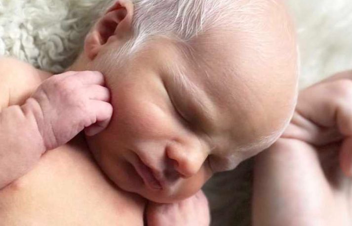 'Woe! Hij heeft echt heel blond haar.' IK WIST HET GEWOON. Mijn man glimlachte. 'Hij is een albinos.' Moeder van 2 zonen met albinisme zegt dat het beste wat ze in hen kan prenten 'zelfvertrouwen' is.