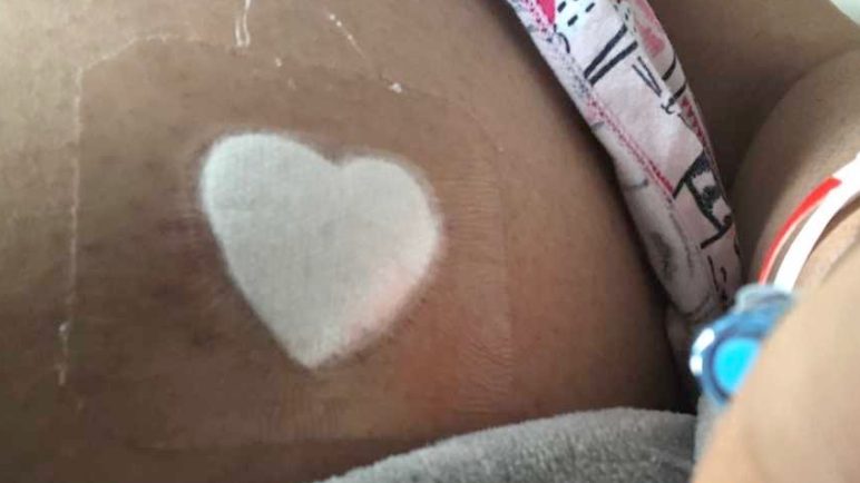 Mijn moeder zei: »Christine, je bent 3 baby's verloren. Denk je dat dit Gods manier is om je verloren baby's terug te geven?« Ik zat daar te huilen.”: Moeder van spontane drieling zegt: „zij zijn mijn helden”.
